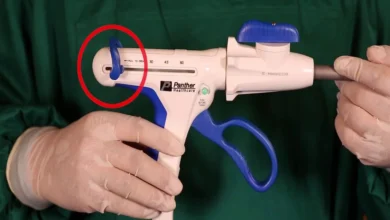 جراحات السمنة وأحدث التقنيات مع الدباسة الذكية